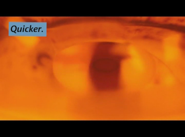 Thumbnail image for Streamline Detection of Diseases